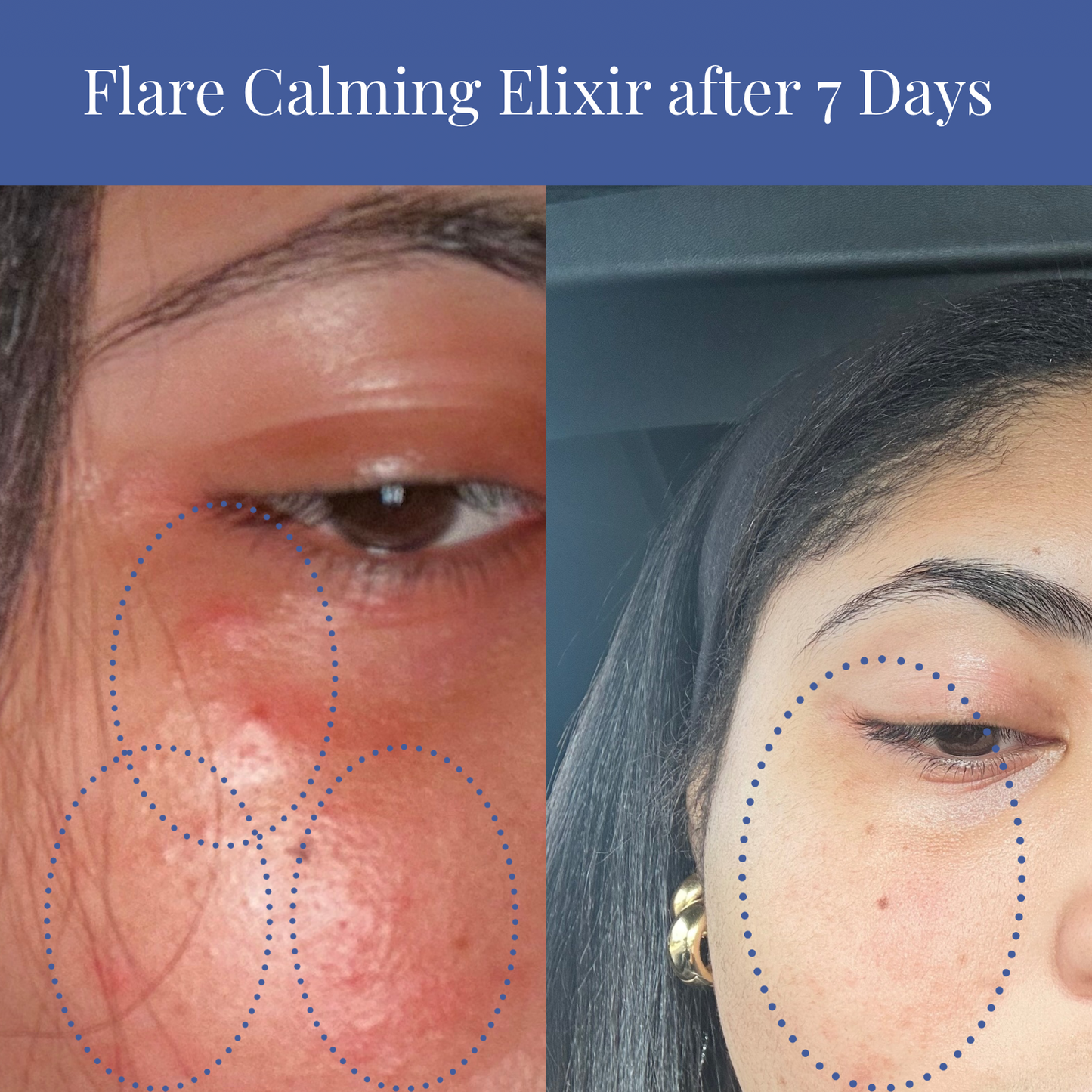 Flare Calming Gel Elixir